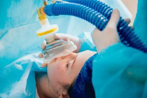 Orientações Sobre Anestesia - Otovita